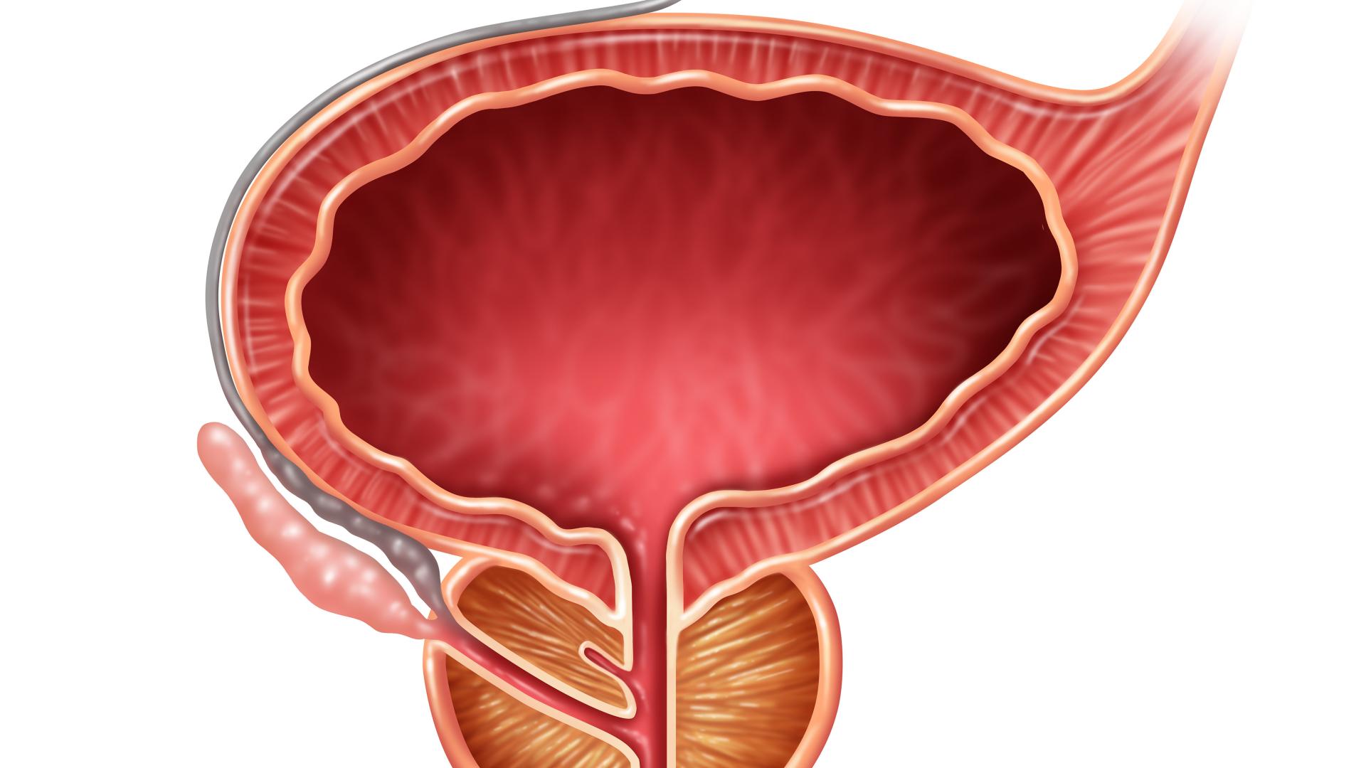 前列腺炎|前列腺炎治好了之后为什么反复？该如何根据自己的身体素质来忌口？