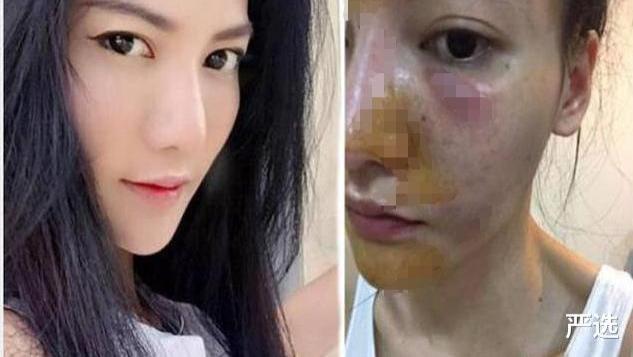 王者荣耀|女子为变白狂打6年美白针，如今变成什么样了？网友：不敢相信