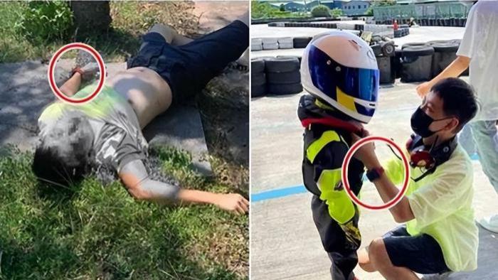 林志颖|林志颖车祸后续：脸部骨折，院长将亲自操刀。