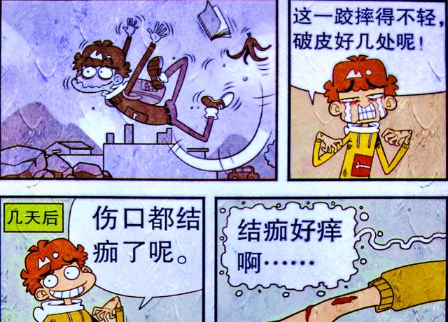 漫画|小衰沉迷揭开“幸运伤疤”，脸姐却沉迷眼睛放大“黑魔法”？