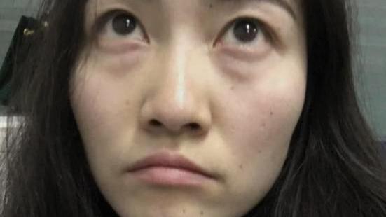 眼霜 一款风很大的“眼霜之王”，在美国卖出50亿吊打兰蔻，抹5次堪比换脸