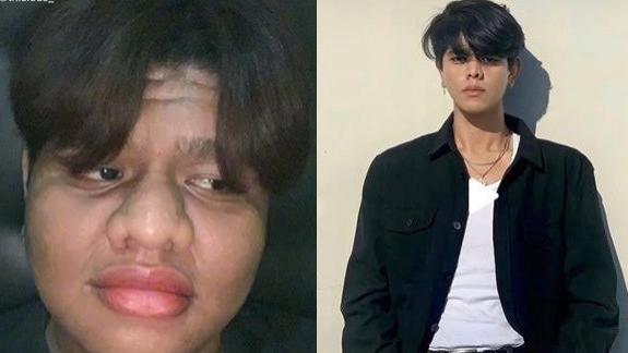 男团 胖小伙遭女友狠甩，减肥成功，逆袭撞脸男团偶像，前后对比照曝光