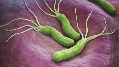 胃病|幽门杆菌“缠身”，身体3处不会“说谎”，医生：1个不占，胃还算强壮