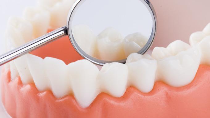 毛利率|耗材并非“天价”补牙的主因 但爱迪特要面对的问题也不仅是集采