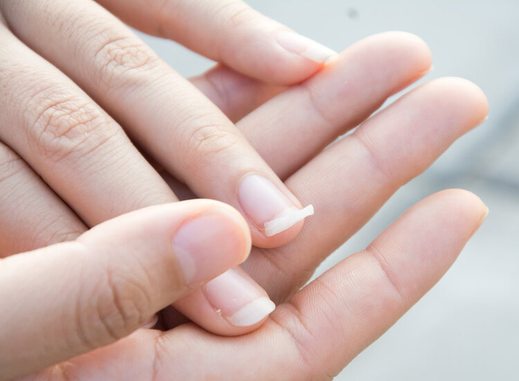 指甲若长成3种样子，可能是癌或疾病的信号，要引起重视