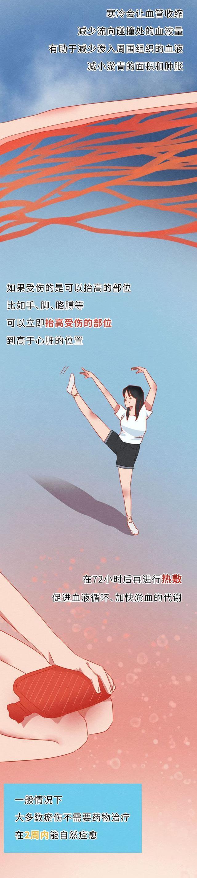 漫画|为什么女生的膝盖上总有“淤青”？一组漫画解惑，别不怀好意