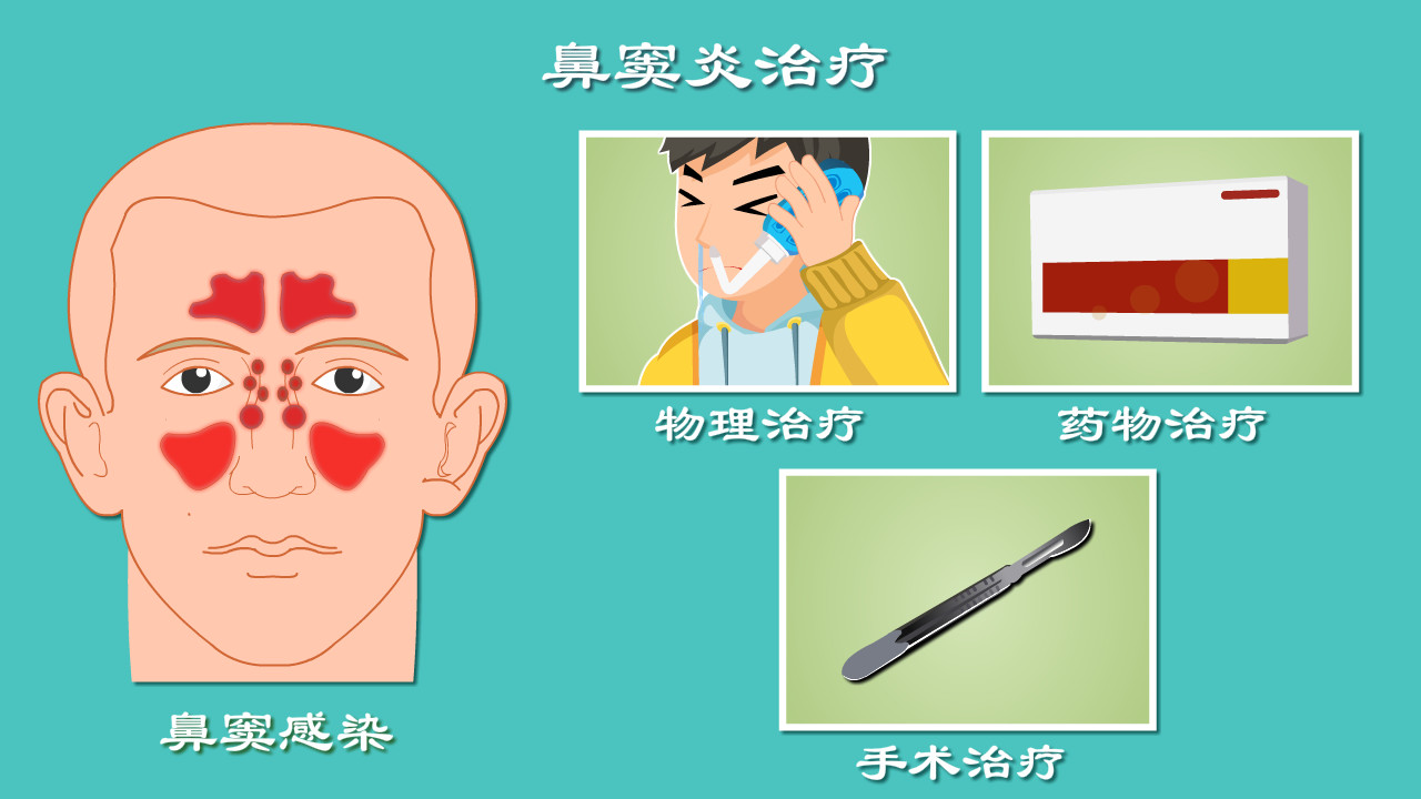 鼻子堵、鼻涕没完没了该咋办? 细数鼻窦炎治疗那些坑, 良心科普贴