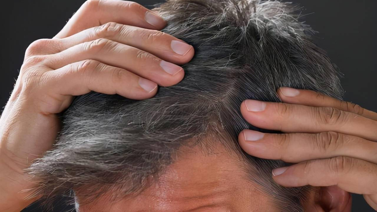 白发|白头发拔1根长10根？医生：最好不要拔，拯救白发这么做