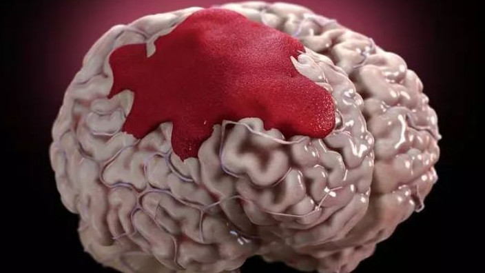 碳酸饮料|“升压王”被发现，是碳酸饮料的10倍，劝告：不想血压飙升，3物快远离