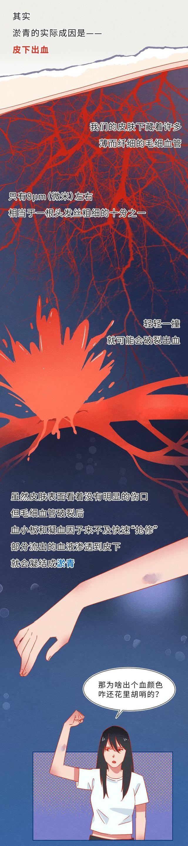 漫画|为什么女生的膝盖上总有“淤青”？一组漫画解惑，别不怀好意