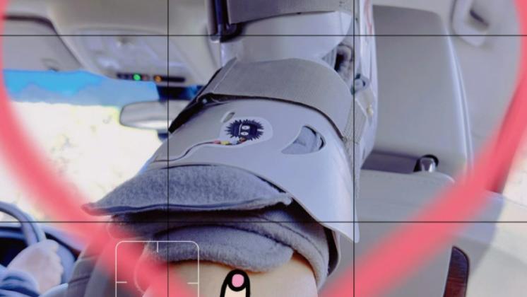 宋智孝|歌手孙悦骨折坐轮椅出行！伤势严重小腿打石膏，穿短裤治疗不怕冷