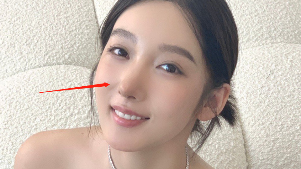 万梓良|都美竹近照鼻头发黑，疑似出现整容后遗症，重考至今没有录取消息