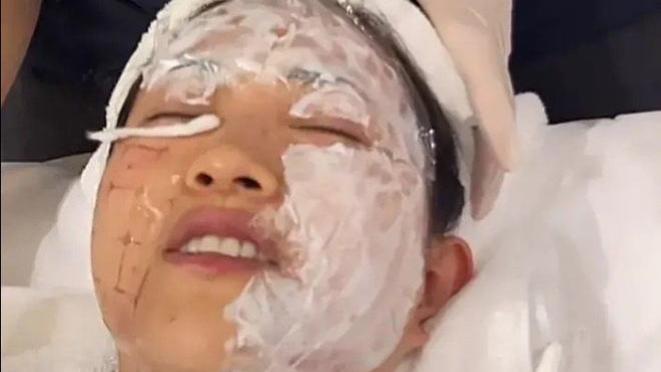 包文婧|包文婧晒做医美全程记录，全程脸肿像包子，全程打麻醉不忍直视