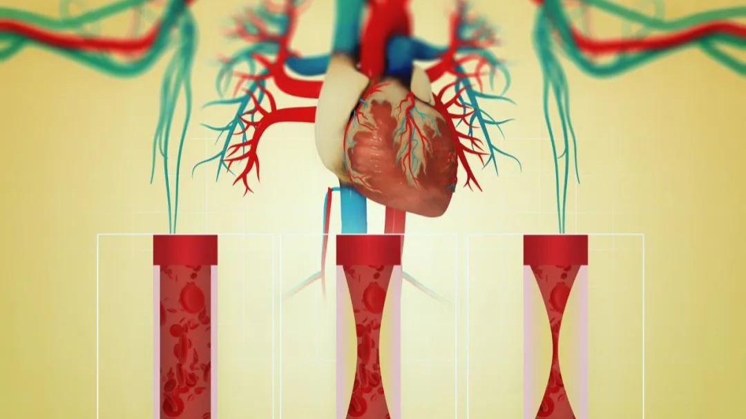 运动|冠脉支架搭了以后不能运动也不能做核磁？这4大误区一定要纠正！