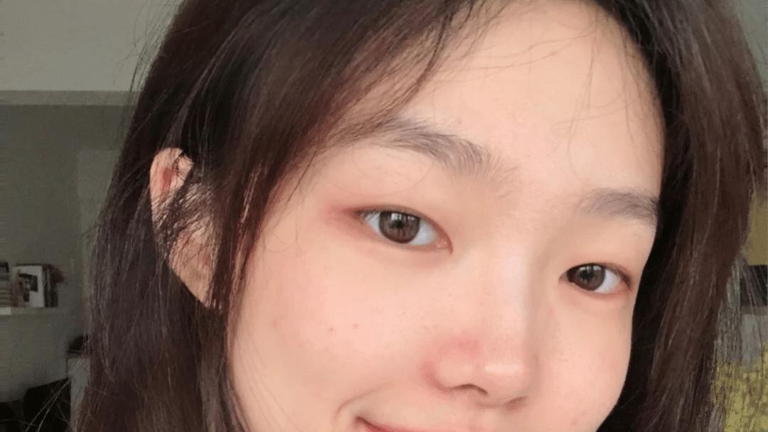 黑头 洗完脸别着急擦水乳，难怪黑头粉刺去不掉，皮肤比别人差