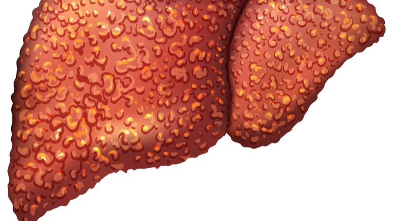 六味地黄丸|身体五种变化别忽视，一种食物媲美护肝王，经常吃一点，不怕熬夜了