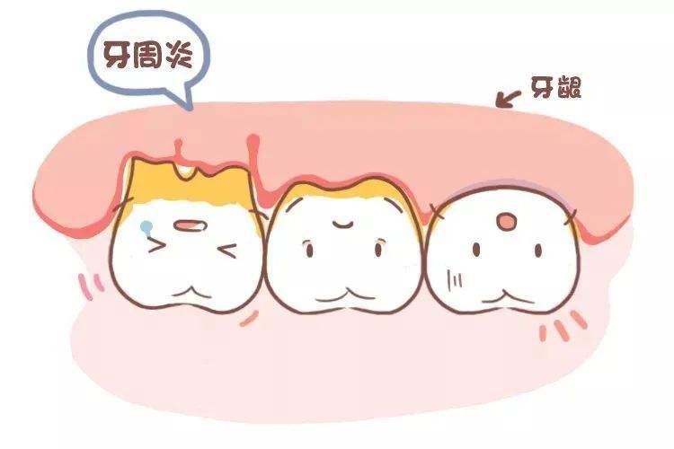 夏天喜欢吃冰冰凉凉的食物,但是牙齿敏感可怎么办?