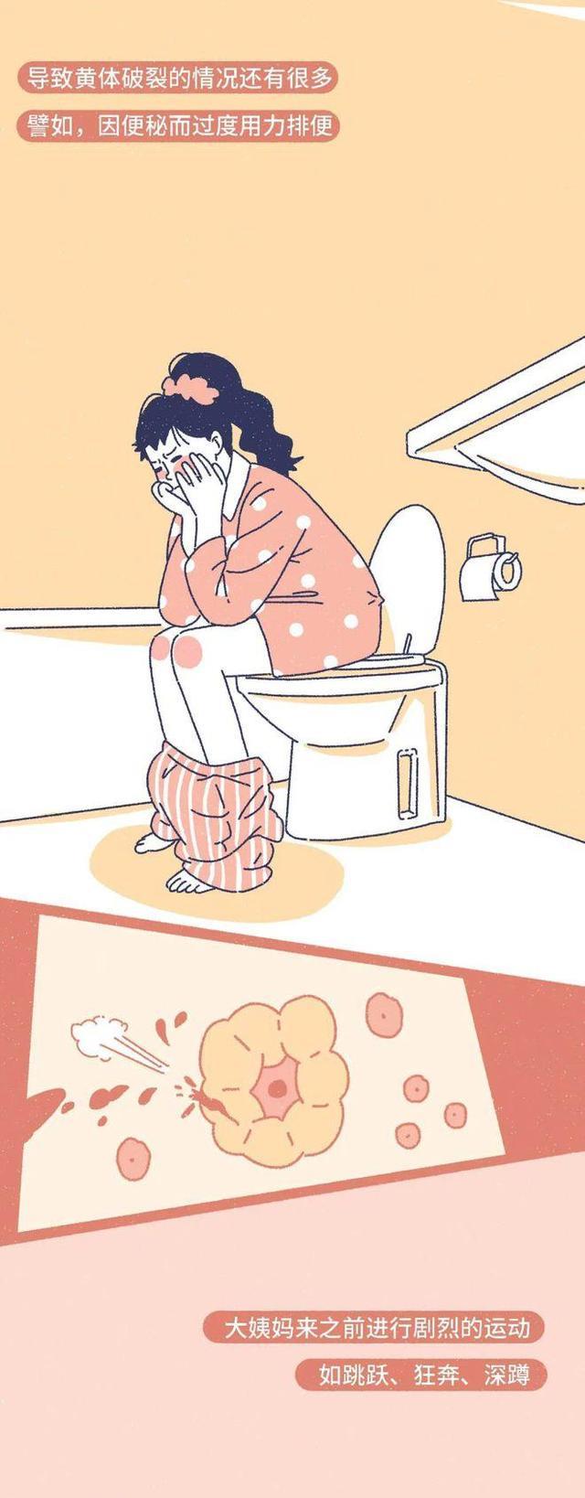 漩涡鸣人|什么是“黄体破裂”?漫画揭晓,女生要重视,男同胞也要注意下