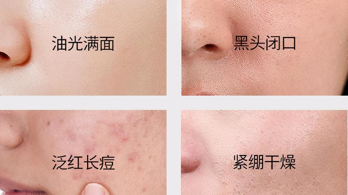 洗面奶 脸上刚“打湿”就涂洗面奶，难怪洗完也出油，皮肤越来越粗糙