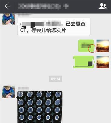 |医生为什么都会拒绝微信上看片子?