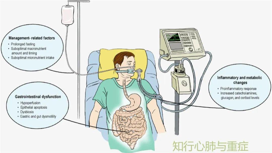 蛋白质|第107期 一文掌握重症患者营养支持的时机、途径以及供给量