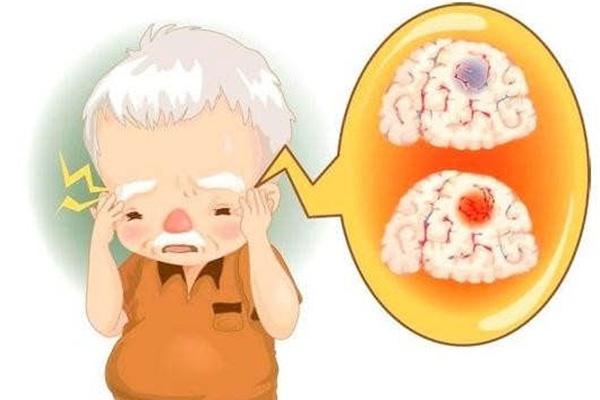 脑供血不足, 可能是这3个原因在“惹事”! 针对预防可以“驱逐”