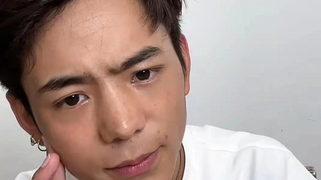 滤镜|丁真直播颜值下跌，发际线后移浮肿，离了滤镜长相被指普通