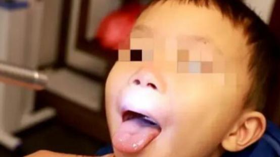 脾胃|为什么孩子的慢性鼻炎总是不见好？真相