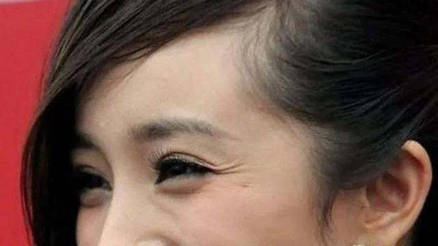 隐婚|被美容针害惨的六位女星，脸僵到哭笑都崩，最惨的直接退圈