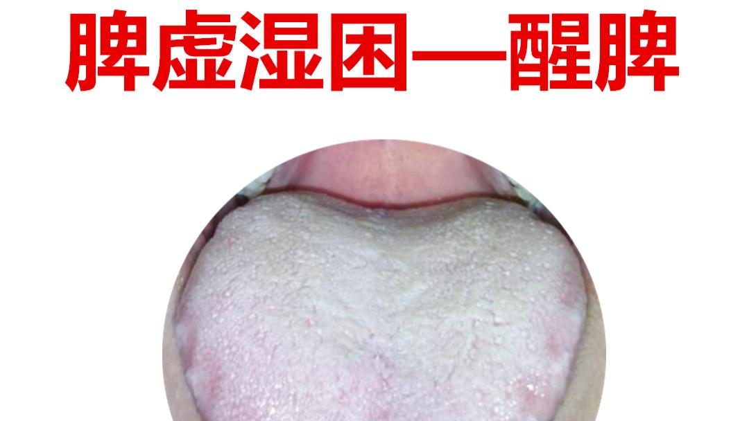 中成药|脾虚百病生，老中医教你几个养脾妙招，养好脾胃不生病