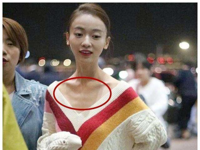 娱乐圈 娱乐圈畸形审美，“皮包骨”、“透光鼻”、“锥子脸”