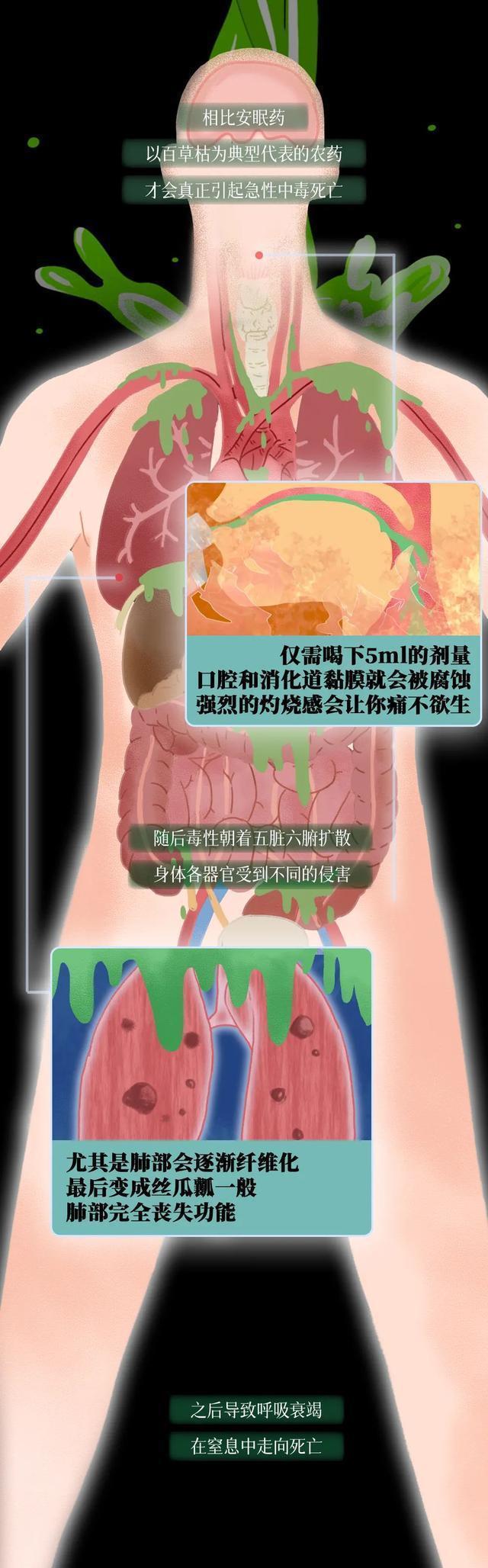 如此美好|人类自杀痛苦程度「对照表」,世界如此美好,请好好珍惜(漫画)