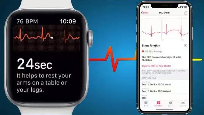 Apple Watch|陈根：Apple Watch向心电图功能精进，苹果精神值得我们学习