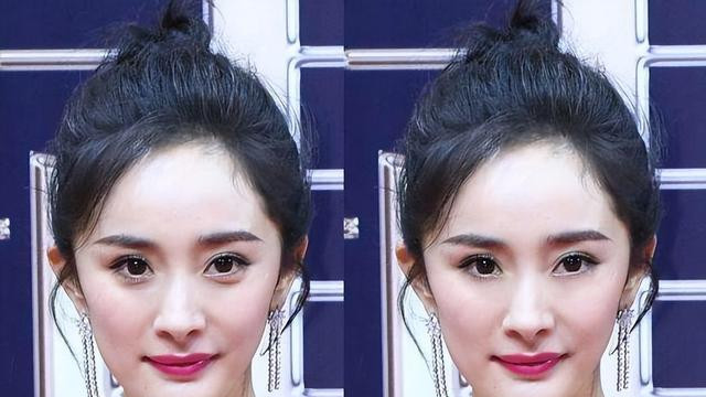 纪实：女子用臀部真皮做卧蚕，手术却意外失败，男友见后：好恶心