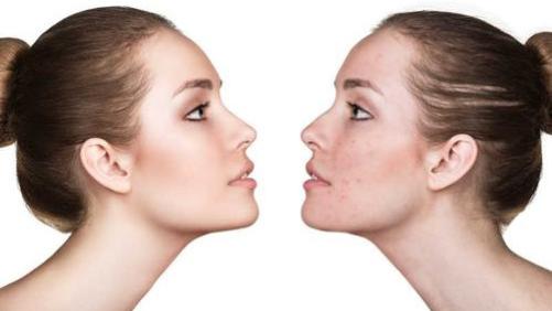 面膜|诗踏绮护肤：混合皮肤建议你这么做