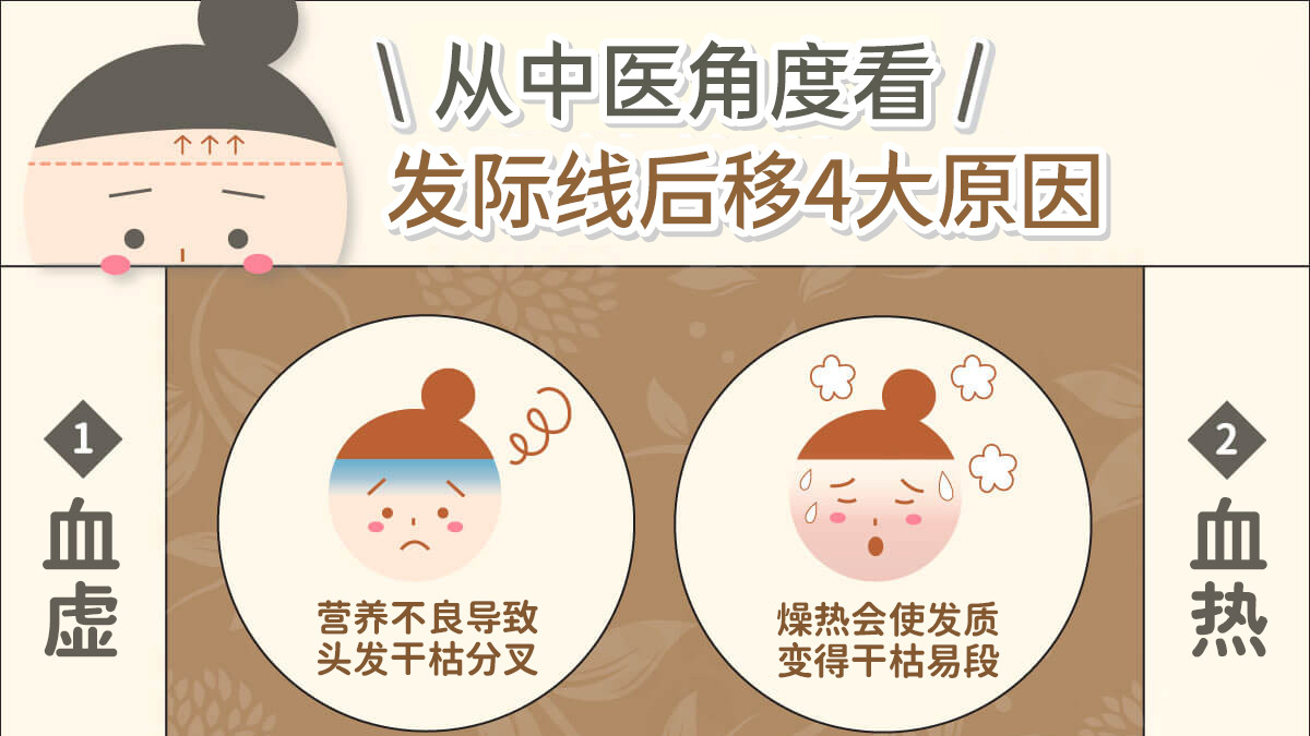 阳痿|发际线越来越后移？由中医角度带你看原因！