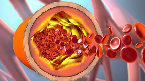 洋葱|吃一口堪比5斤洋葱，提醒：血脂高的人敞开吃，脑梗不敢“上门纠缠”