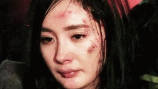 姜广涛|杨幂受伤9天后首露面，左眼伤势疑似曝光，网友：低估了