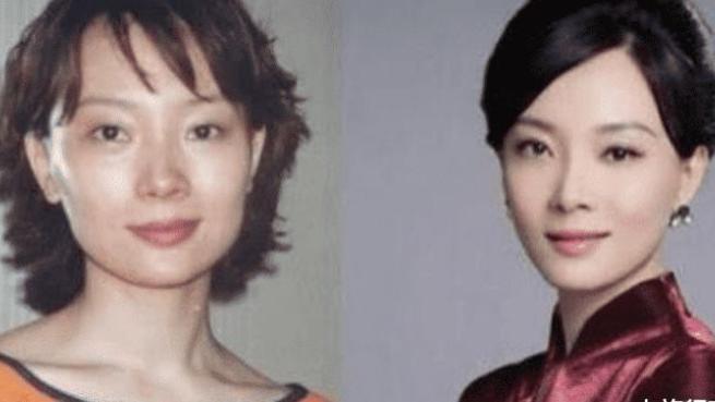 整容|整容最成功的4位女星！虽然已“千刀万剐”，但却毫无痕迹