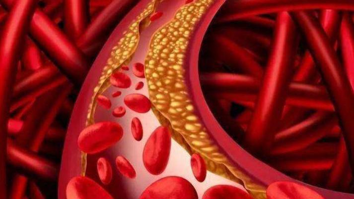 莲花清瘟胶囊|吃一口相当于6个苹果，心内科主任：血脂高的人坚持吃，血管或一通到底