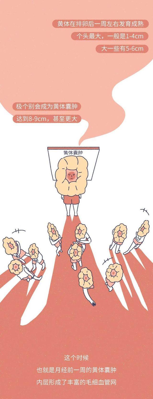 漩涡鸣人|什么是“黄体破裂”?漫画揭晓,女生要重视,男同胞也要注意下