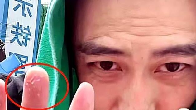 李飞|李飞直播卖鱼双手被泡起皮，为哪般？不过是另辟蹊径找出路罢了