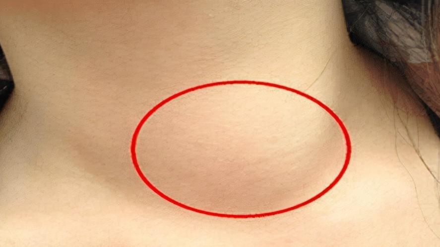 干眼症|多家医院联合呼吁：芹菜和2物同食，堪称“散结王”，敞开吃，结节或消失无踪