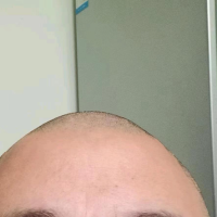 光头老侯