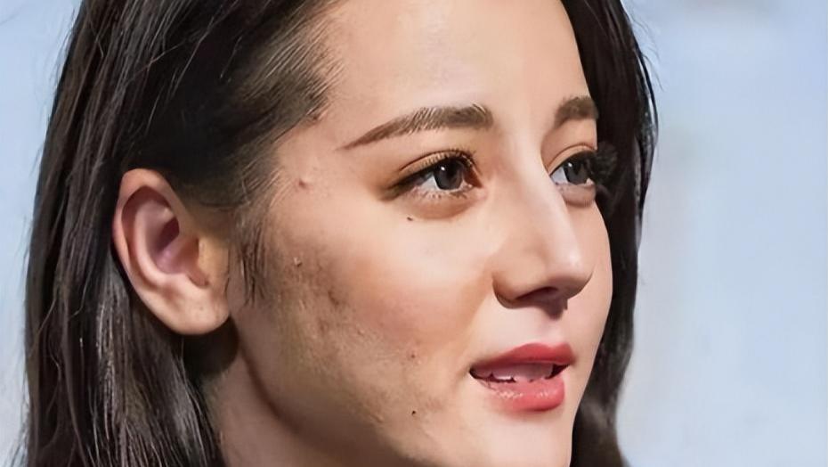 皮肤黑、满脸痘、卡粉，明星生图让我们看见人间真实