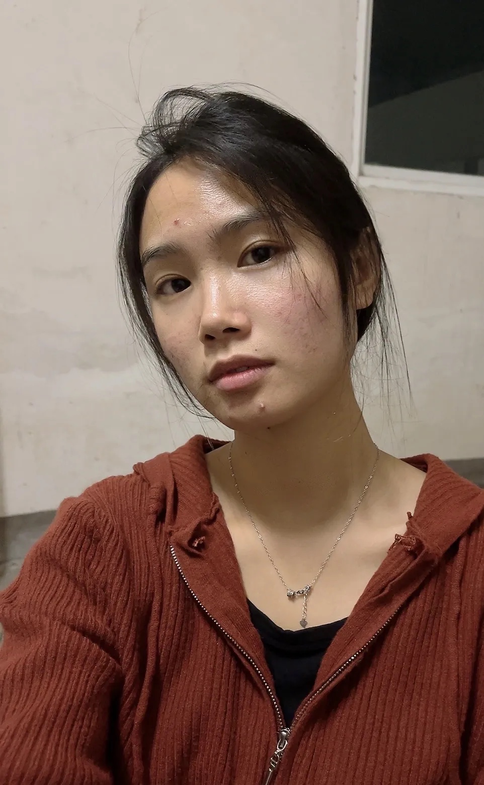 这一年就要结束了，可是我的脸从未好过。陷入容貌焦虑中
