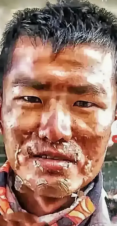 震撼！这是高原边防军人的脸。看了让人又感动又心疼，是他们常年不分昼夜地在海拔五千