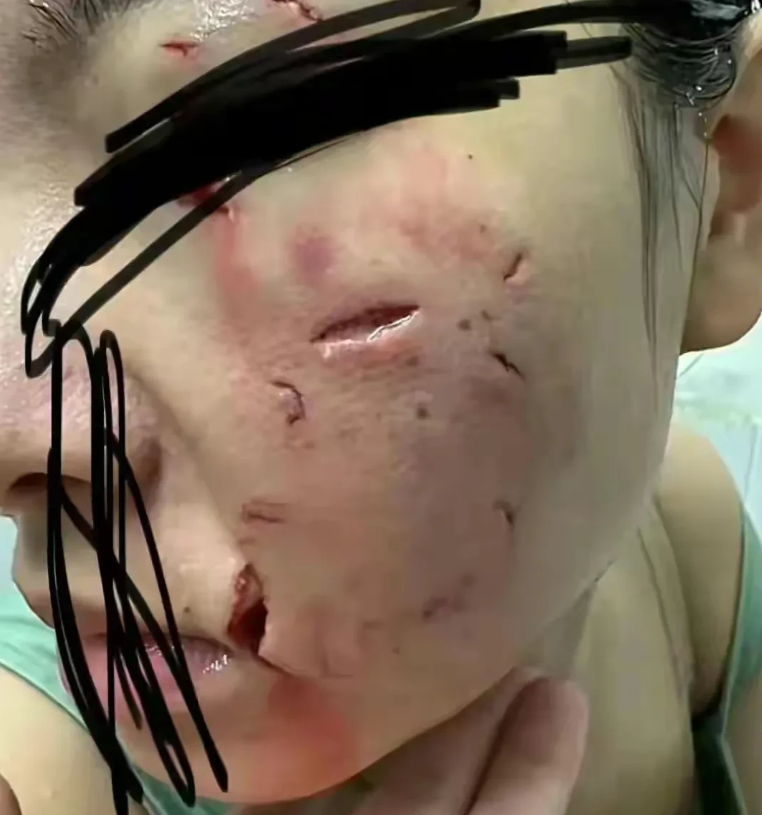 法院判决结果

经过审理，二审法院最终维持了一审判决，并驳回了女子的上诉请求。
