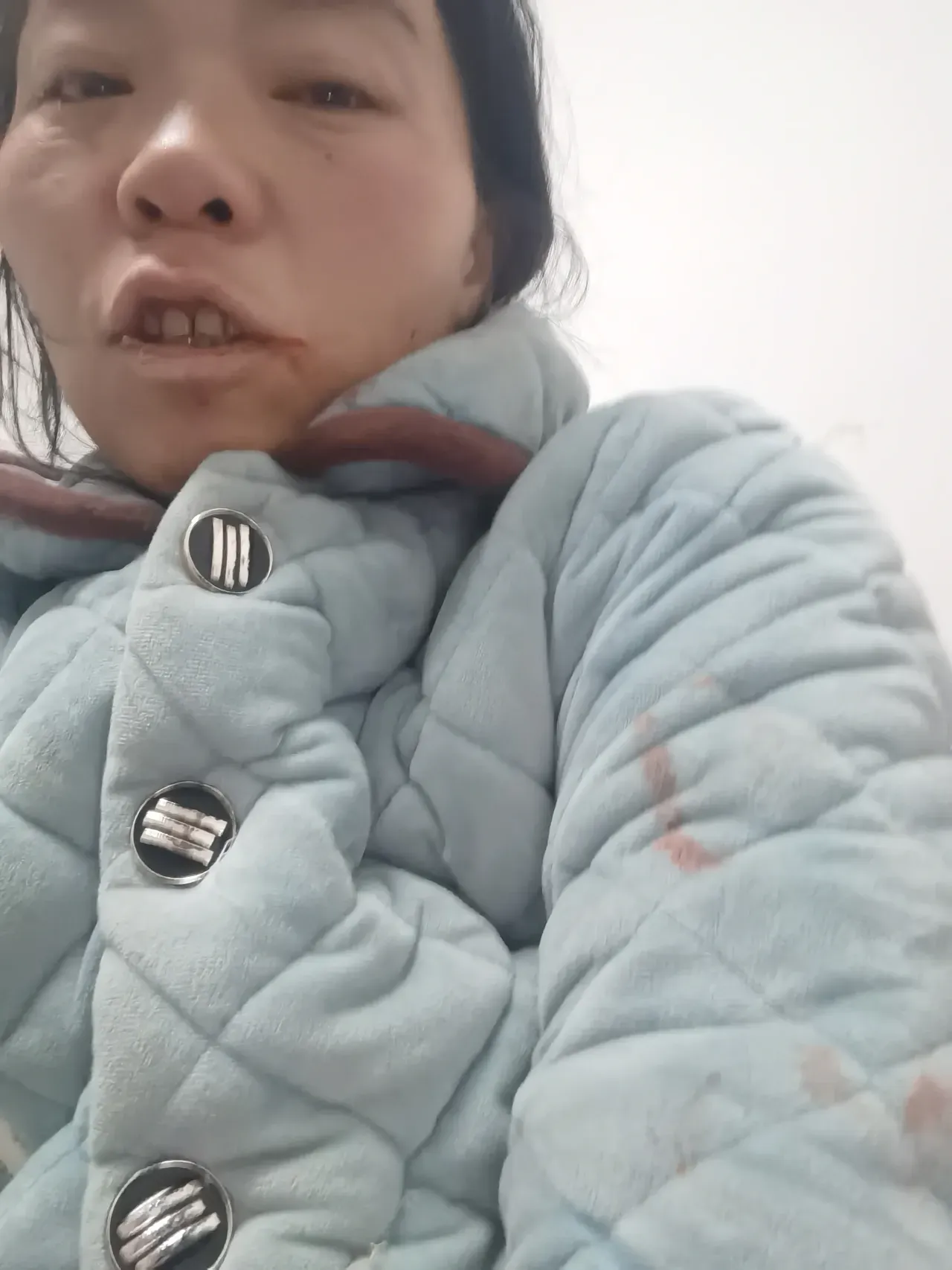 这辈子我没有娘家！忍够了！ 
   我四十多岁了，每年给娘家四，五万，老人住院伺