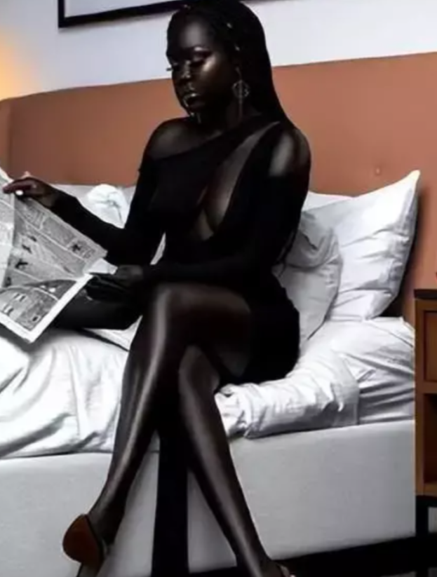 你实在是太黑了，我愿意出一笔巨款，为你漂白皮肤。2020年，一名黑人女名模因为自